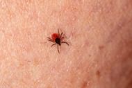Here are some of the symptoms of tick bite. (Image via pexels/erik karits)
